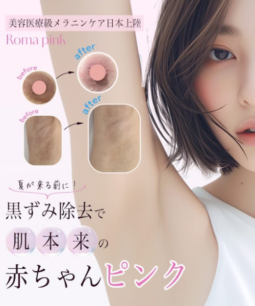 ローマピンク
